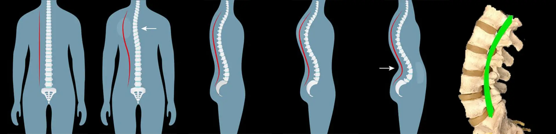 chiropractic-biophysics-banner